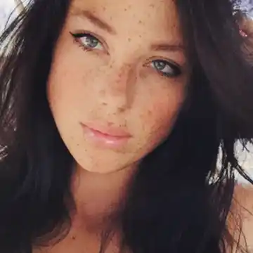 Las pecas se pusieron de moda y ahora también se compran
