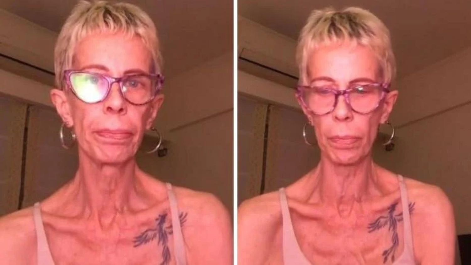 Por un tratamiento odontológico mal realizado, María Valenzuela pesa 35 kilos y preocupa a todos