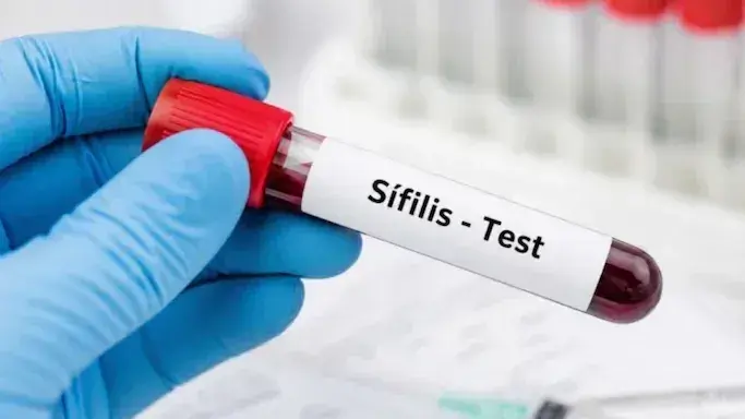 Alerta por el aumento de casos de sífilis en Argentina: crecieron un 26% entre las mujeres