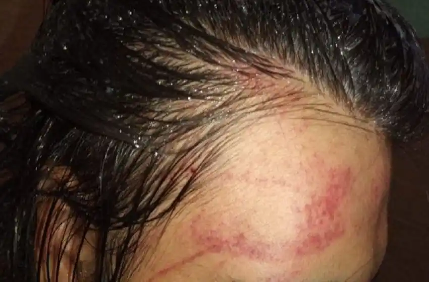 Brutal golpiza a una chica trans de 16 años: la atacaron en patota en una fiesta