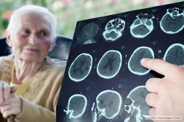 Científicos argentinos buscan revelar la "firma molecular" del Alzheimer
