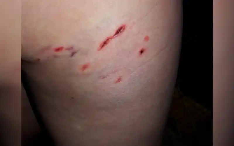 Perro mordió a una mujer en Novillo, entre Salta y Pellegrini