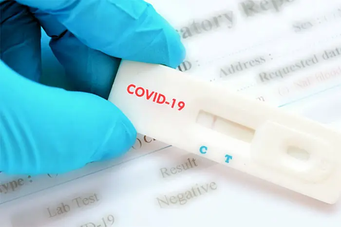 Pandemia en el país: se registró el número más bajo de contagios de los últimos dos meses