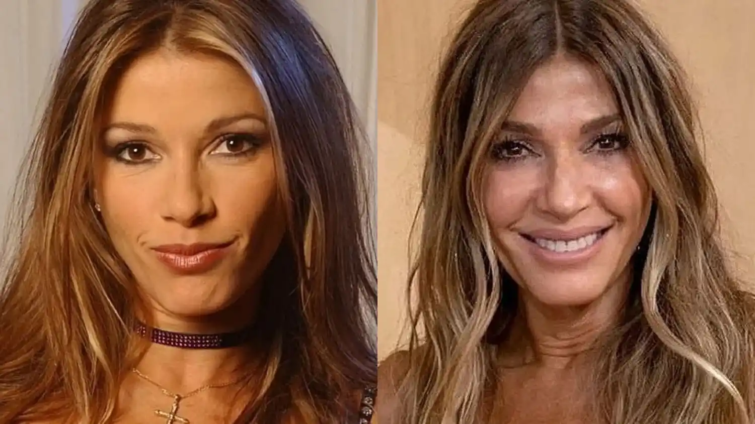 Catherine Fulop sufrió un accidente doméstico y tuvo que ser atendida de urgencia
