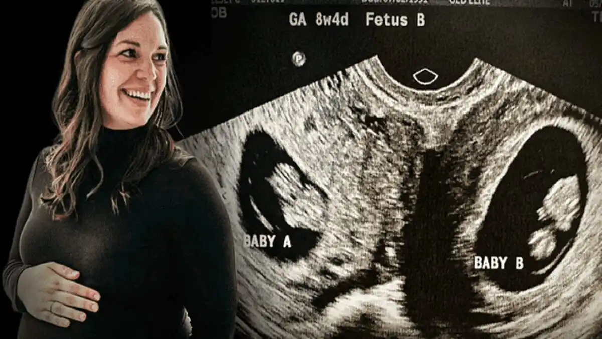 EL RARO CASO de la mujer con dos úteros que resultó embarazada en ambos