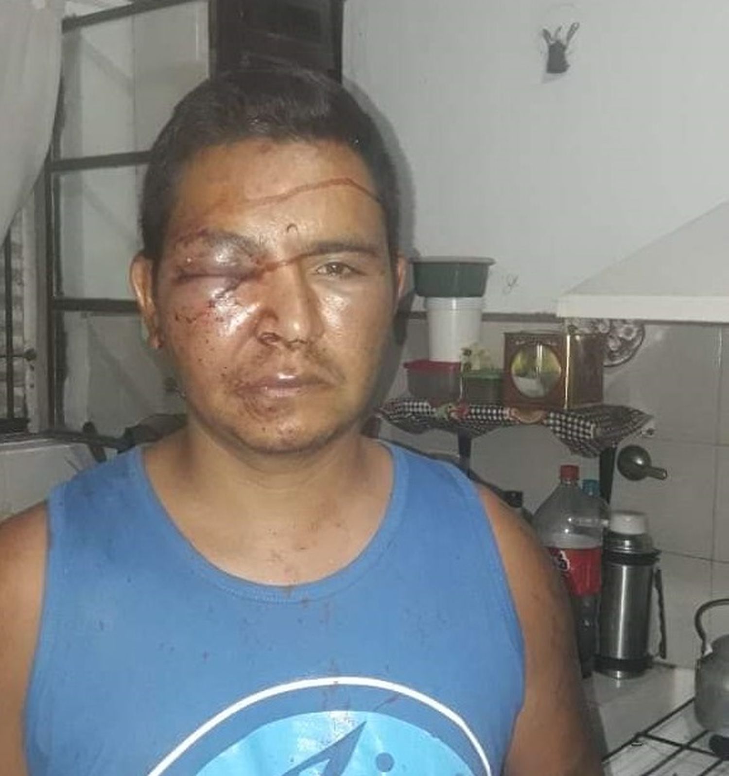 Lo tiraron de la bicicleta para golpearlo en el piso y reprocharle que no podía “pasar por ahí”