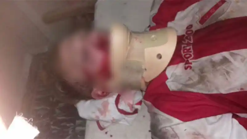 Jugador golpeó a otro, lo dejó inconsciente y se fugó del partido en moto