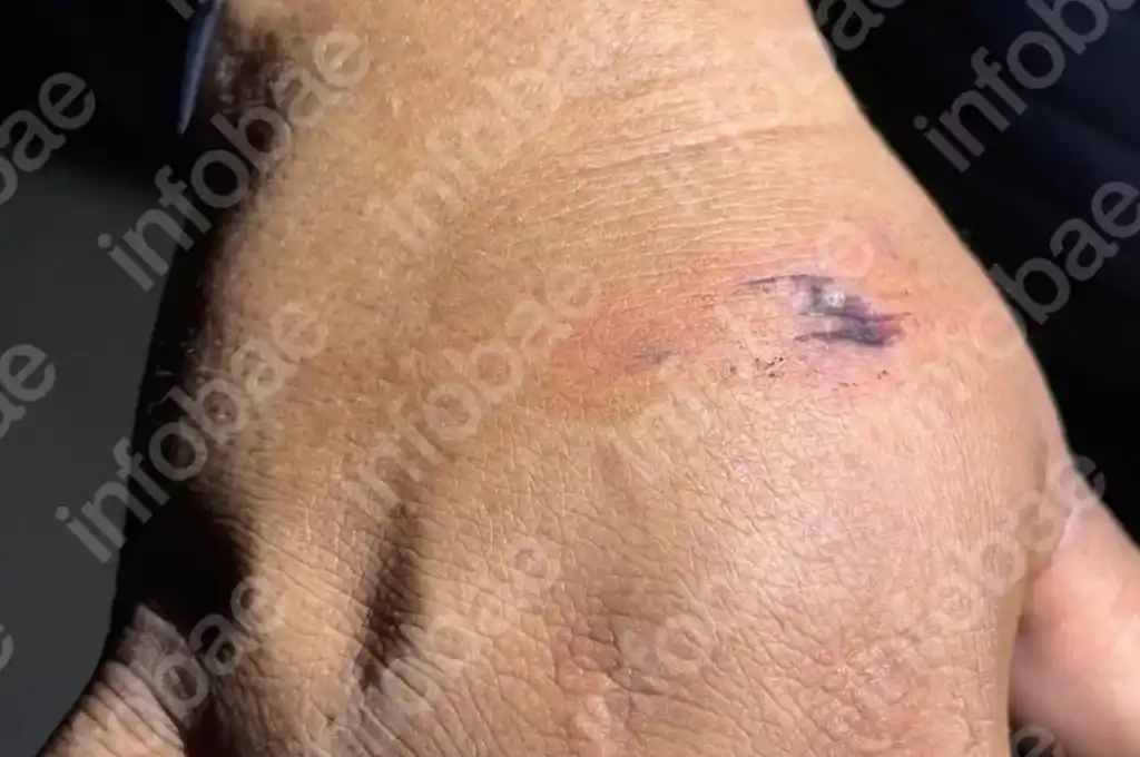 heridas en manos triple crimen 4