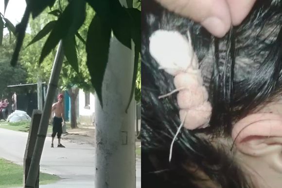 Barrio 2 de Abril: un detenido por disparar contra el hijo de su expareja