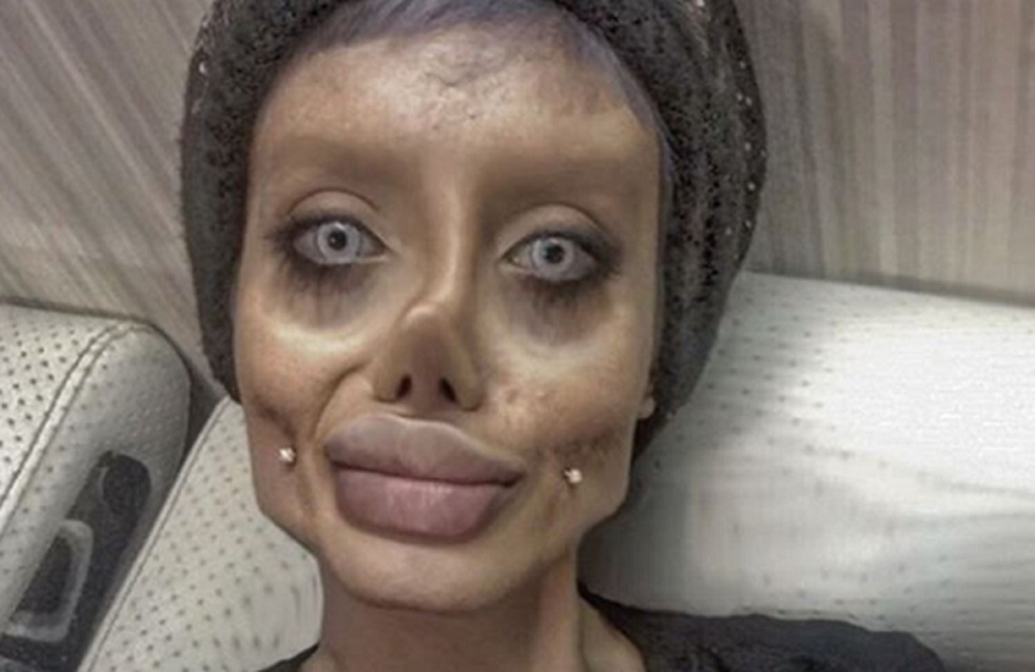 Una joven iraní se sometió a 50 cirugías para parecerse a Angelina Jolie