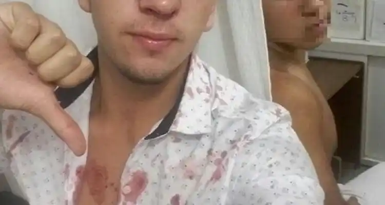 Adolescente fue golpeado por una patota que se movilizaba a bordo de un Falcon gris