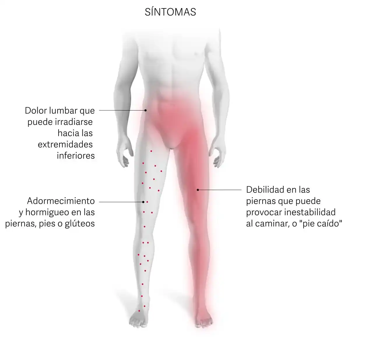 El dolor de espalda que aparece al caminar y desaparece al sentarse: no es solo un problema de la edad