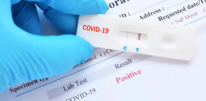 Pandemia: Argentina superó los 700 mil contagios de coronavirus