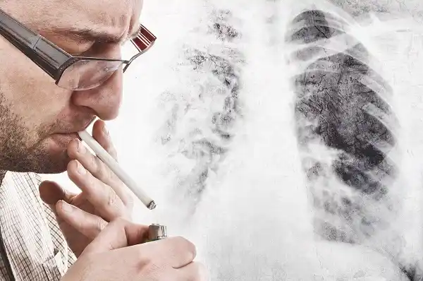 ¿Qué es la EPOC? ¿Se puede prevenir?
