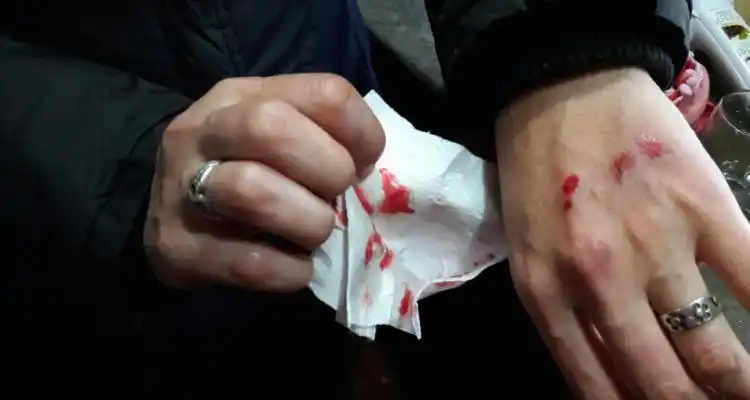 Motochorros lastimaron y robaron a una mujer que circulaba en bicicleta
