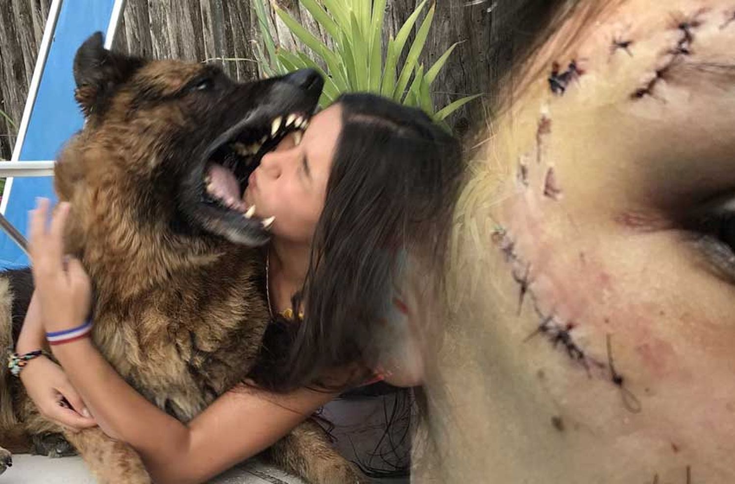 Quería posar en una foto con su perro, lo molestó y terminó con la cara destrozada