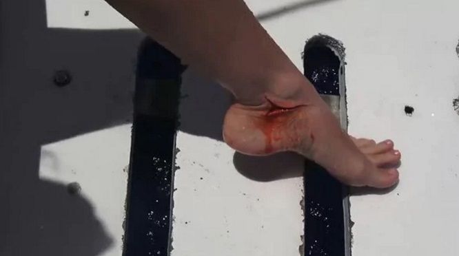 Video: actriz porno atacada por un tiburón durante una grabación