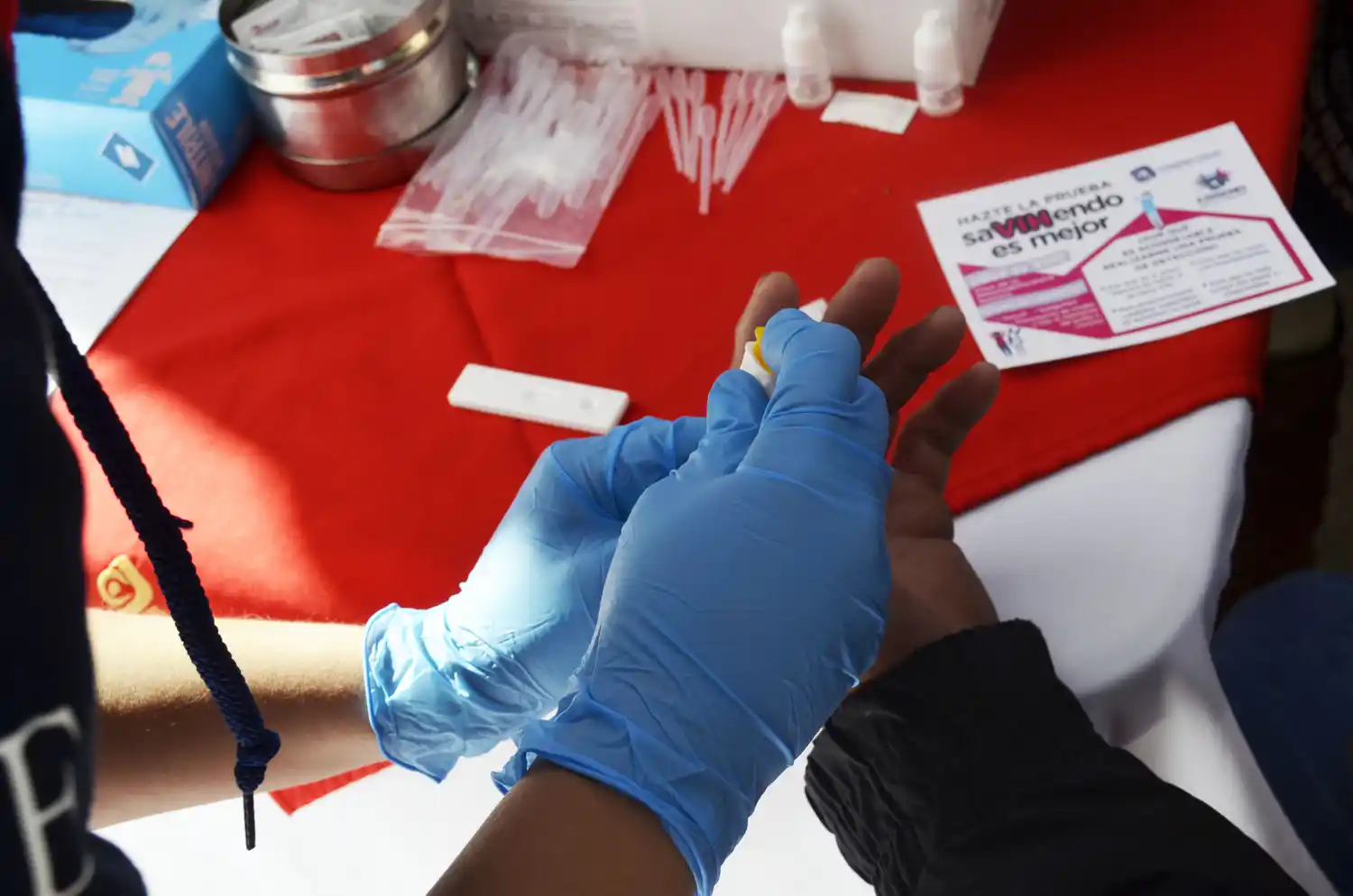 La pandemia de Covid19 puede echar por tierra los avances contra el VIH