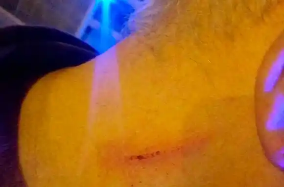 Zona Roja: enfrentamiento entre una trans y un vecino en una noche de furia