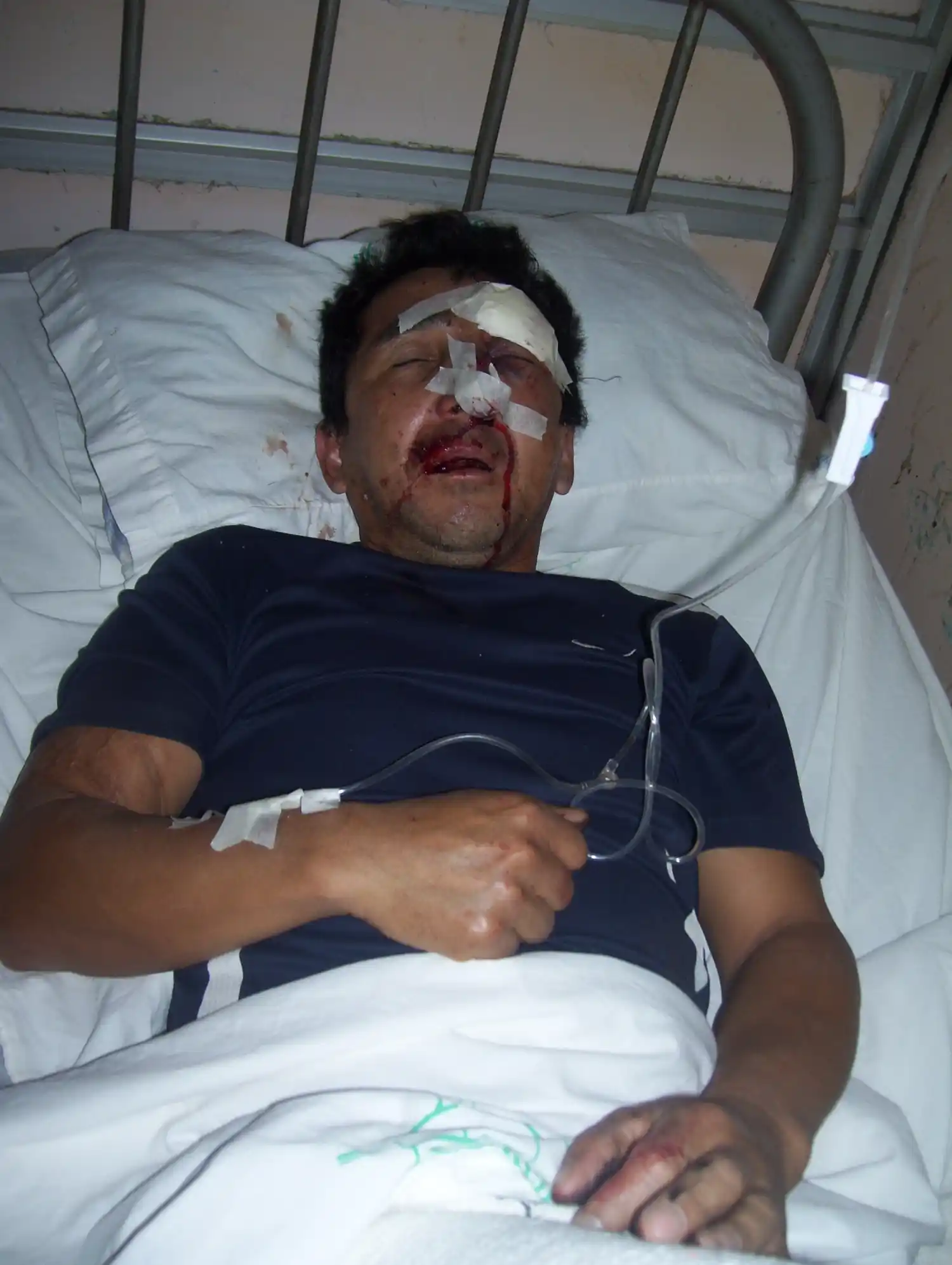 En breve será llevado a juicio el delincuente golpeado por la víctima 