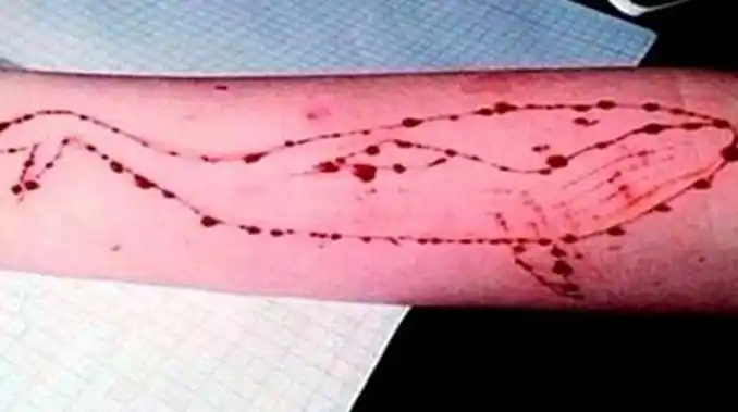 Investigan posible caso de "Ballena Azul" con una nena de 12 años en La Plata