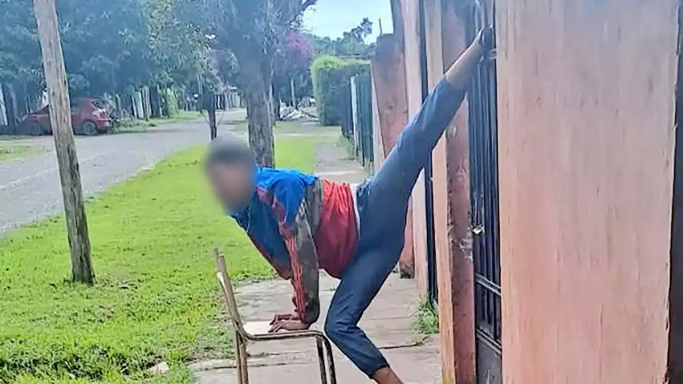 El joven de 18 años se resbaló por la lluvia y resultó gravemente herido.