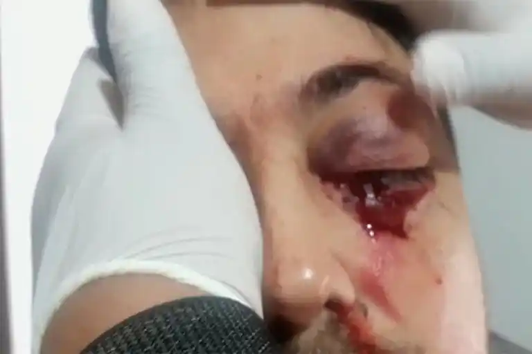 Una discusión en el "chat de mamis" terminó con una brutal pelea frente al colegio