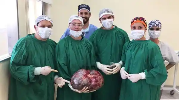 Le extrajeron un tumor de 15 kilos a una mujer en Catamarca