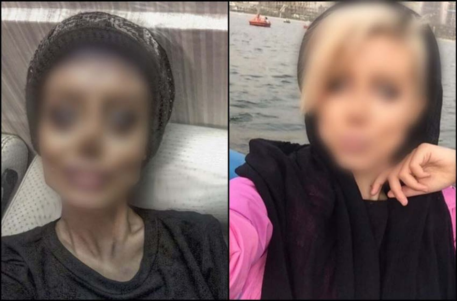 Una iraní se operó varias veces para lucir como Angelina Jolie