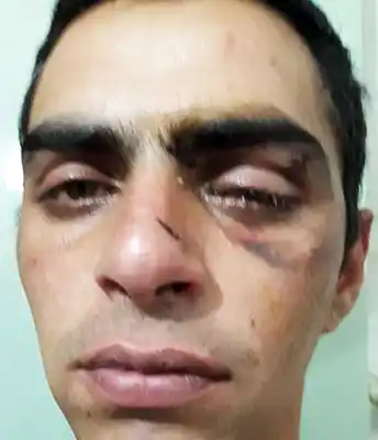 Investigan la golpiza que sufrió un joven en el barrio Fonavi