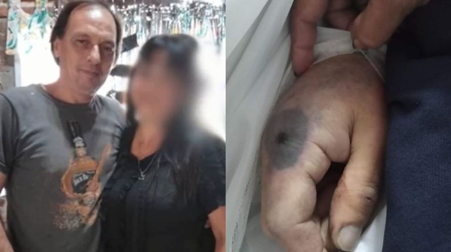 Un bonaerense fue picado por una araña y murió: Denuncian mala praxis