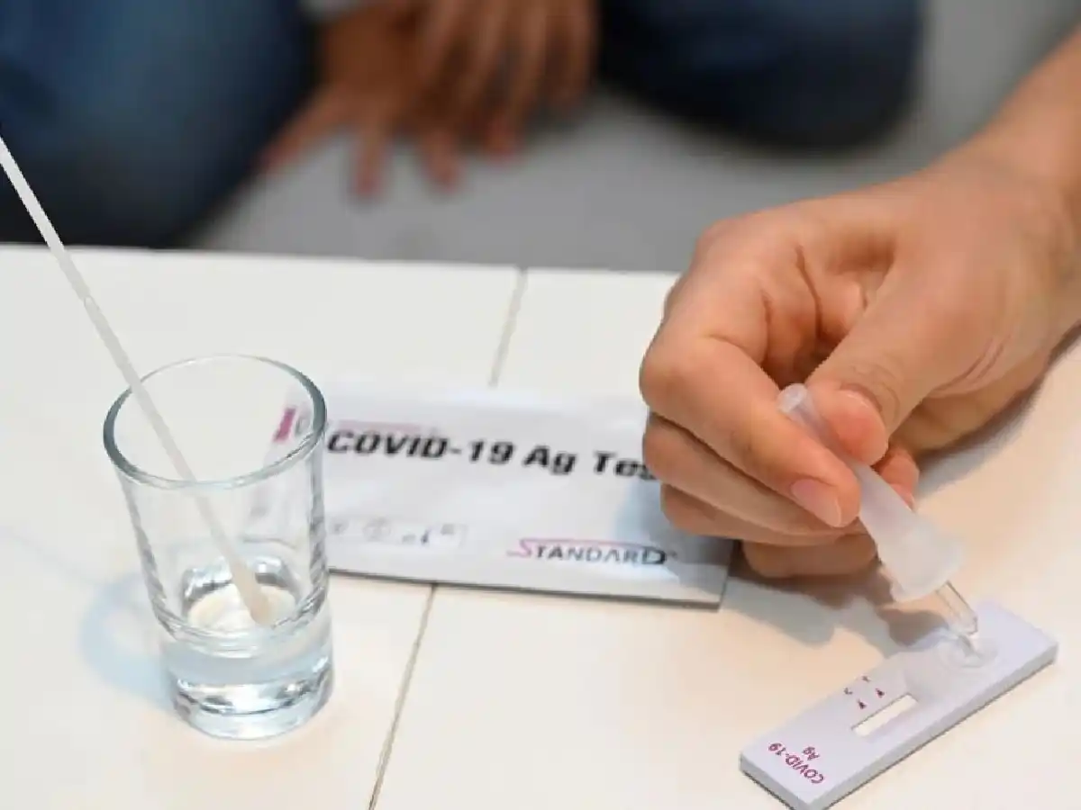 Autotest: el gobierno estableció cómo será la venta y reporte del resultado