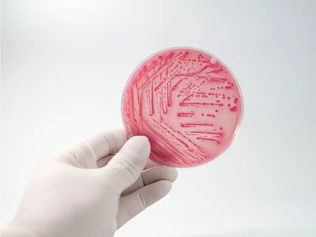 Otro caso de Síndrome Urémico Hemolítico: Una nena de Coronel Suárez contrajo la bacteria