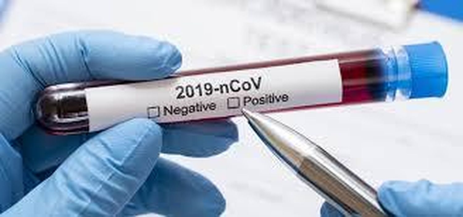 El Departamento Concordia confirmó 92 nuevos casos de coronavirus