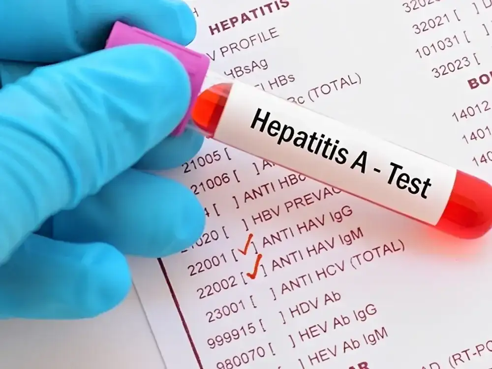Se confirmaron 32 casos nuevos de hepatits A y el país entró en zona de alerta sanitaria.