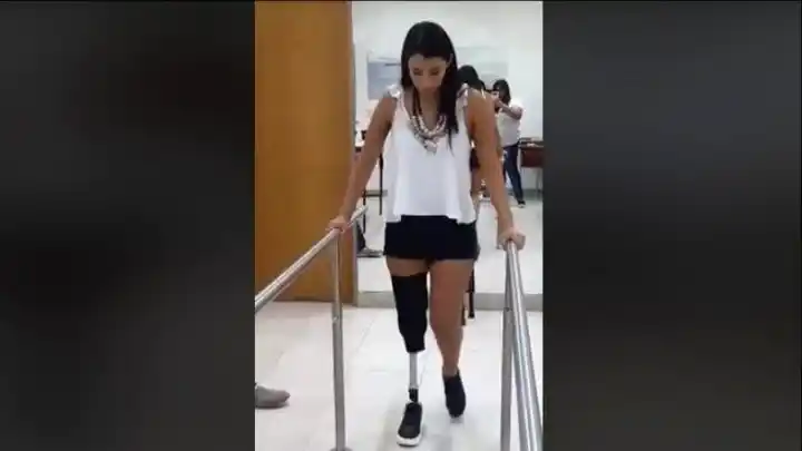 Discriminación: no la dejaron entrar al boliche por usar pierna ortopédica