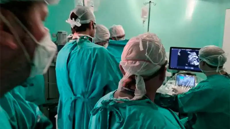 Operaron del corazón a un bebé de 32 semanas en el vientre de su madre