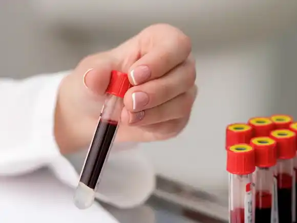 Variante Frankenstein en Argentina: revelaron el rasgo que comparten los infectados