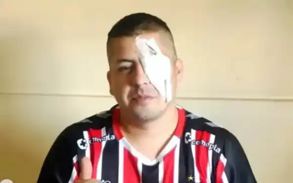 Quién es el hincha de Chacarita y vecino de San Martín que denuncia a Bullrich: perdió un ojo en represión del Congreso