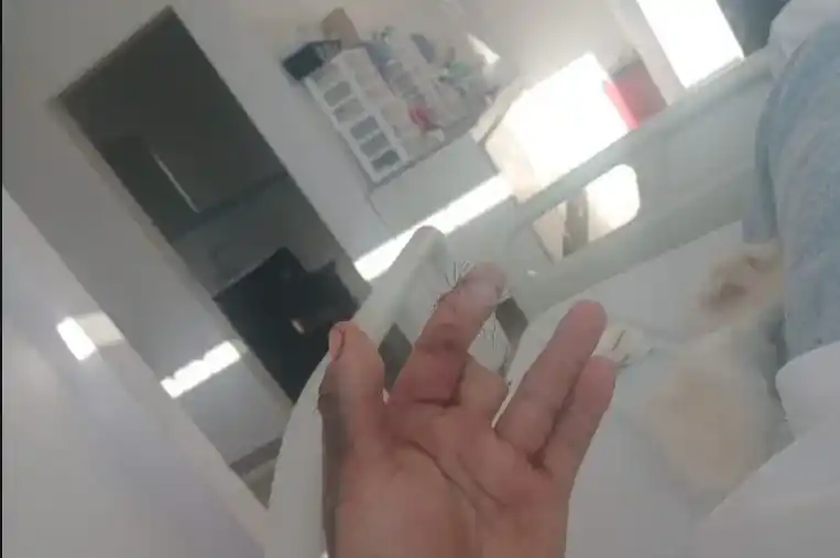 Mario Encina sufrió heridas graves, incluida la amputación de un dedo.