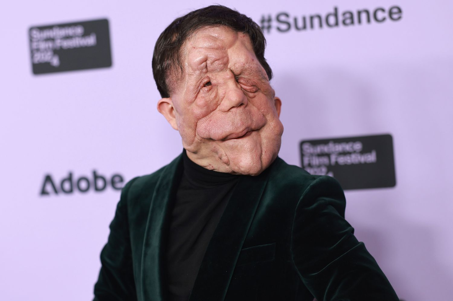 La historia del actor Adam Pearson y su enfermedad que le desfiguró el rostro