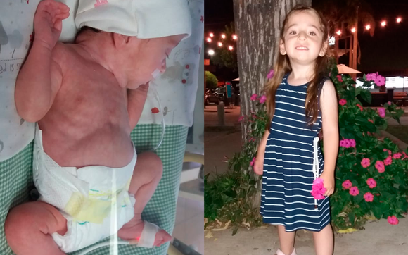 #NeoEnSanPedro: la historia de Laia, que pronto comienza el jardín