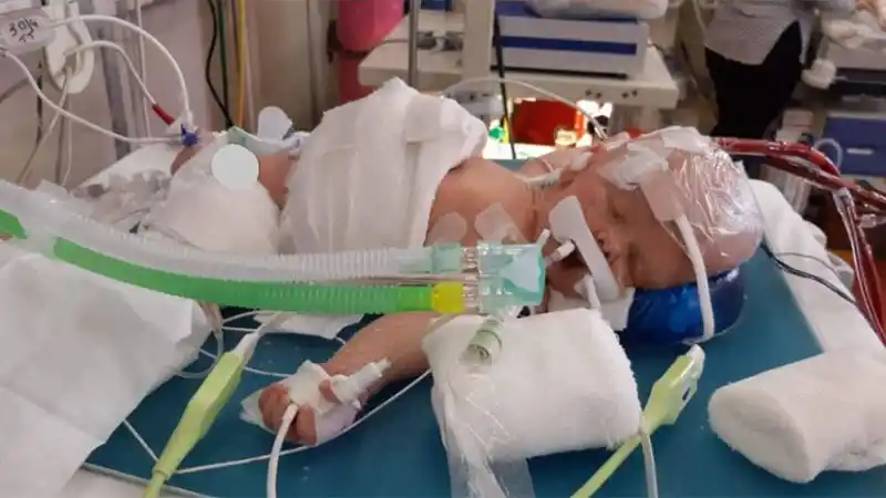 Desconectaron a un bebé entrerriano esperando lo peor, sin embargo ocurrió un milagro