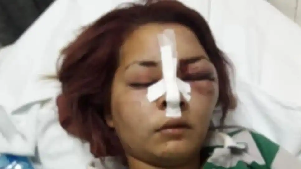 Una joven desfiguró a otra "por ser linda": ahora amenazan a la agresora