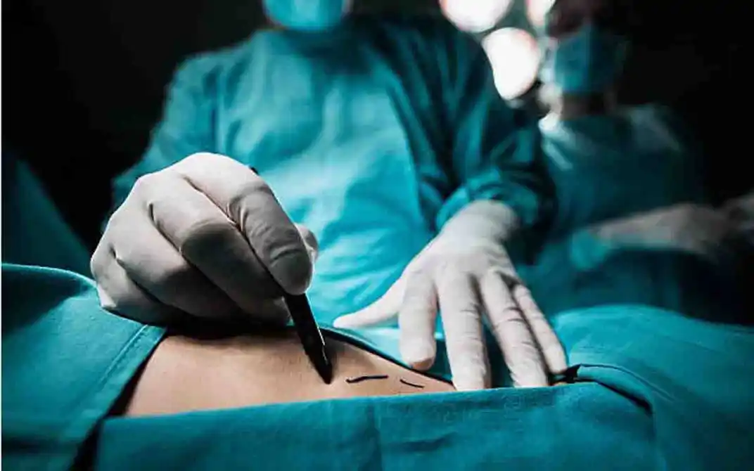 Mujer murió tras liposucción hecha en una casa