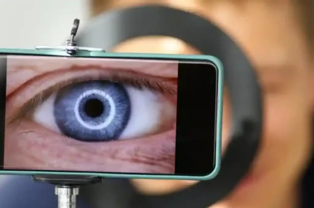 Diseñan una app que detecta demencia senil o Alzheimer escaneando la pupila