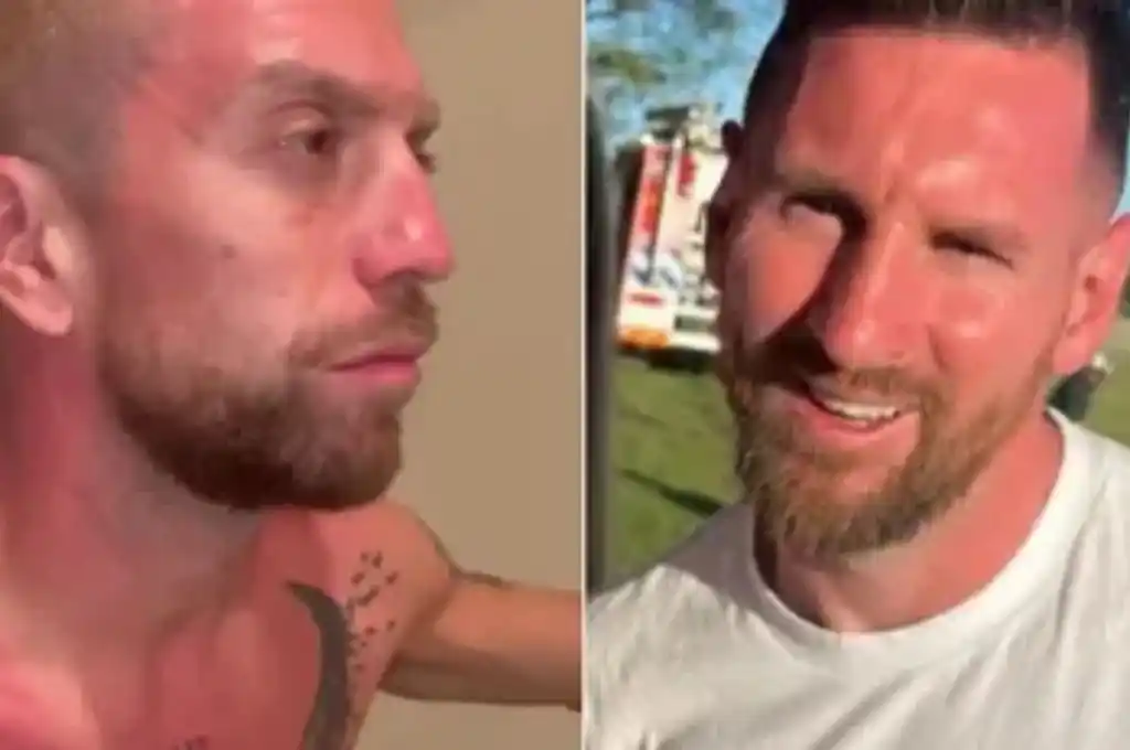 Cómo usar el aloe vera para las quemaduras