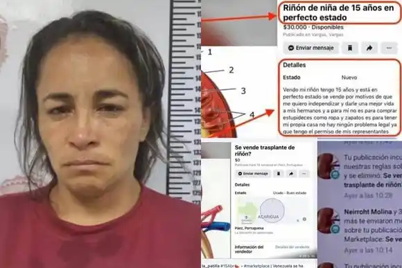 MARKETPLACE: de estafadores a vendedores de órganos: detienen a mujer que ofrecía un riñón por $20.000