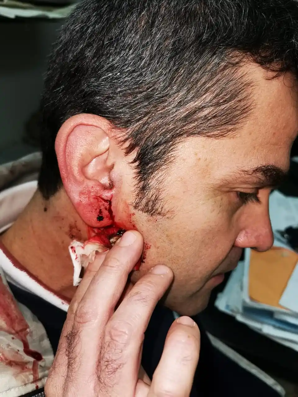 Impidieron el ingreso a la planta a tres trabajadores de Unilever y uno fue agredido