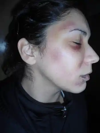Denunció a su novio por una brutal golpiza que duró varias horas